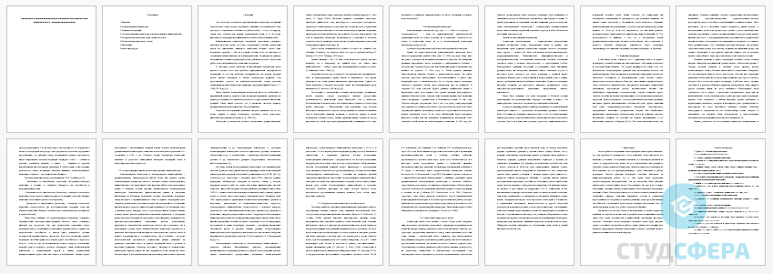 Реферат на тему: Сознание и межполушарная асимметрия мозга. два полушария –   единое мышление